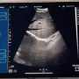 hand-held-ultrasound.webp